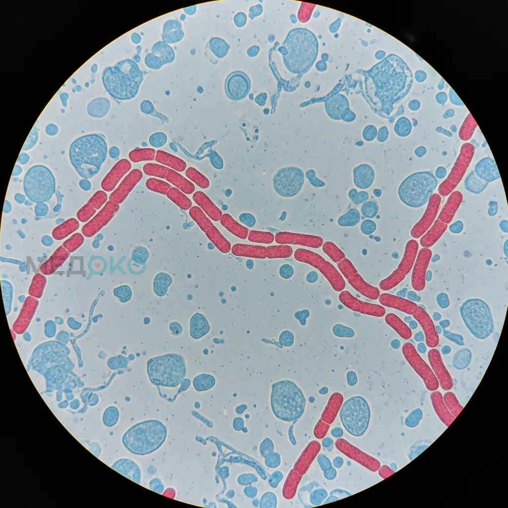 Микрофотография Mycobacterium tuberculosis под микроскопом