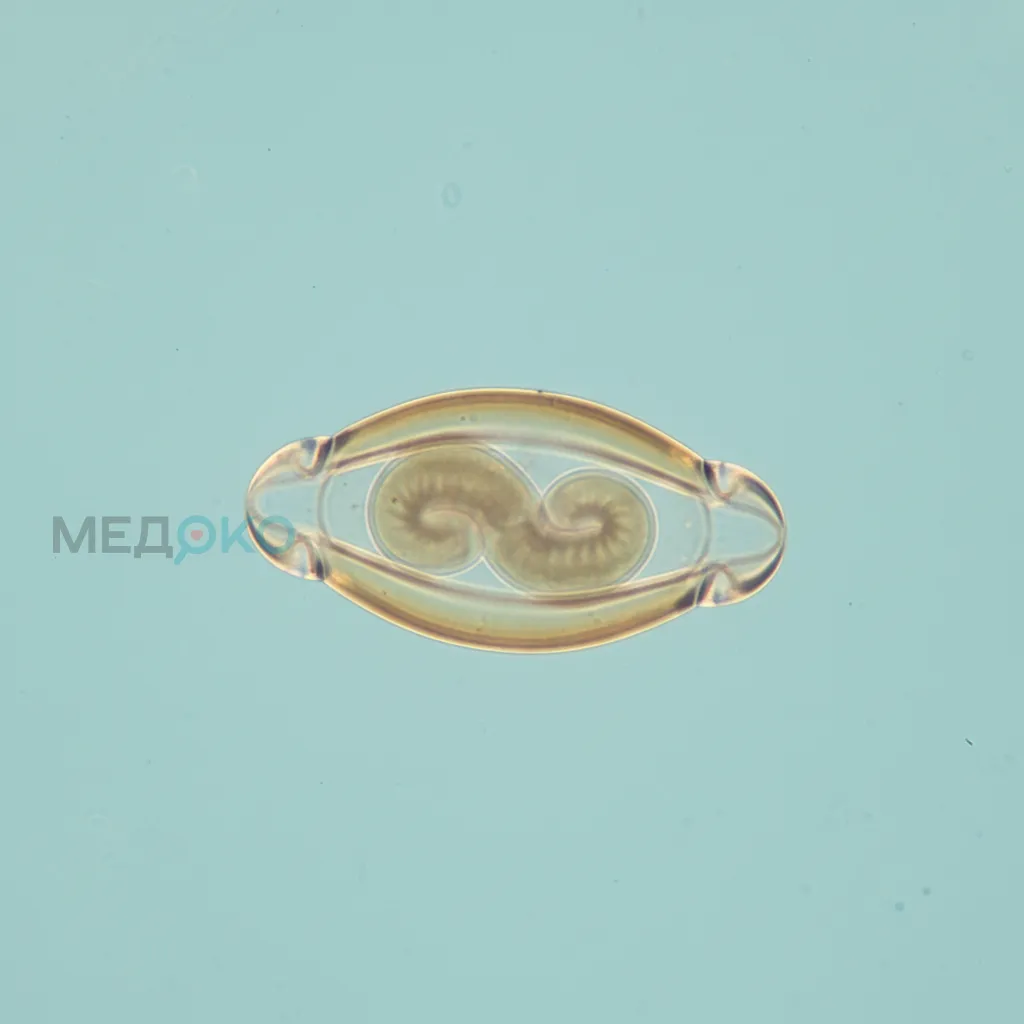 Микрофотография яйца Trichuris trichiura